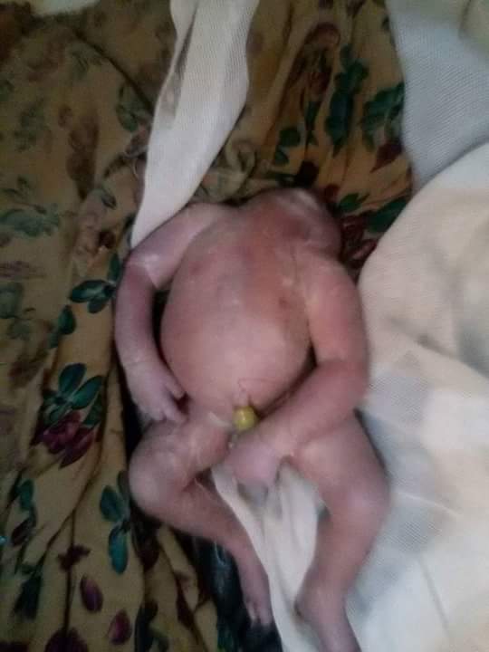 له‌ گه‌رمیان منداڵێكی بێ سه‌ر له‌ دایك ده‌بێت